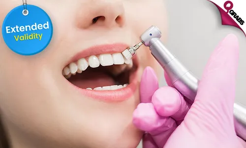 Teeth Whitening with Scaling & Polishing!